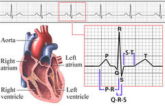 EKG-ul nu poate diagnostica toate anomaliile inimii