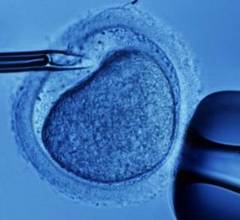 Fertilizarea in vitro va avea un program national