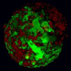 Sindromul oboselii cronice, in stransa legatura cu un virus