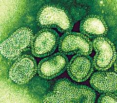 Un virus ucigas, descoperit in Australia