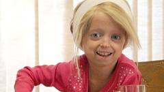Progeria, boala copiilor batrani - Ce spune medicul