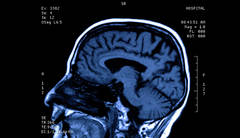 Loviturile la cap, chiar minore, accelereaza imbatranirea creierului