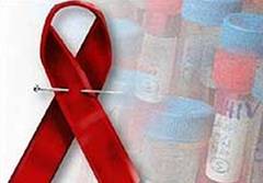 Peste jumatate din bolnavii cu HIV din Romania au pana in 29 de ani