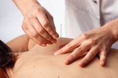 Acupunctura poate fi eficienta impotriva bronsitei cronice