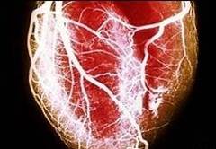 Cum te protejezi de infarct: opreste fluxul sangvin din brat!