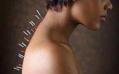 Trateaza-ti depresia, in timpul sarcinii, prin acupunctura!