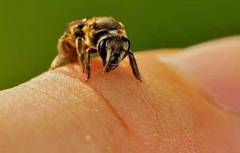 Terapia cu albine, pentru reumatism si artrita