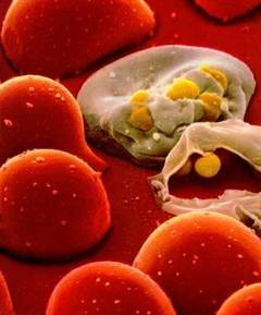 A fost descoperita o noua tulpina a virusului HIV