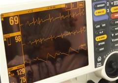 Primul stimulator cardiac wireless
