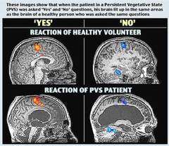 Pacientii in stare vegetativa pot comunica
