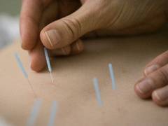 Cum poate fi tratata epilepsia prin acupunctura?