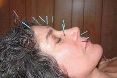 Acupunctura raspandeste hepatita si HIV