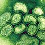 Un virus ucigas, descoperit in Australia