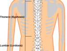 Care sunt cele mai sensibile zone la coloana vertebrala?