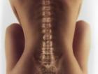 Diagnosticarea problemelor coloanei vertebrale