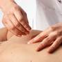 Acupunctura poate fi eficienta impotriva bronsitei cronice