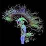 O noua metoda de scanare a creierului, pentru depistarea Alzheimer