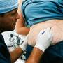 Interventie chirurgicala 2 in 1: liposuctie si marire de sani