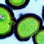 Infectiile cu stafilococi, invinse cu vitamina B3