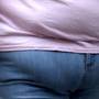 Grasimea de pe abdomen duce la migrene