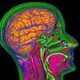Vitamina B reface creierul celor care au suferit un atac cerebral